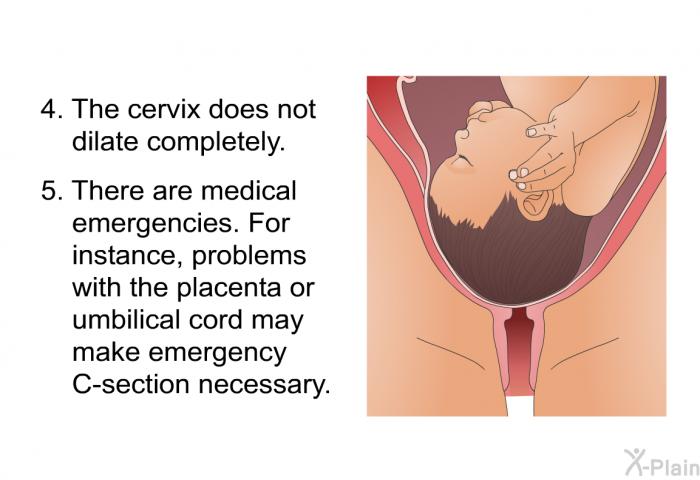The cervix does not dilate completely. There are medical emergencies. For instance, problems with the placenta or umbilical cord may make emergency C-section necessary.