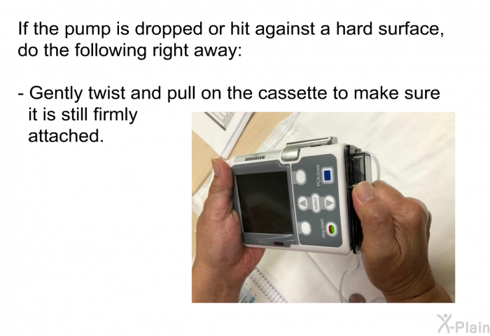 If the pump is dropped or hit against a hard surface, do the following right away:  Gently twist and pull on the cassette to make sure it is still firmly attached.