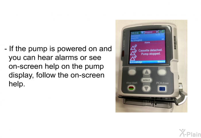 If the pump is powered on and you can hear alarms or see on-screen help on the pump display, follow the on-screen help.