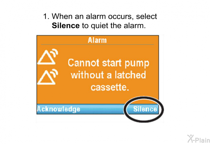 When an alarm occurs, select<B> Silence</B> to quiet the alarm.