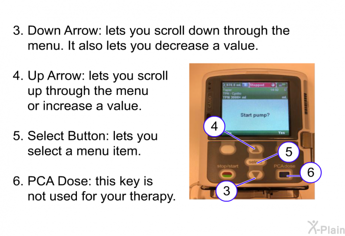 Down Arrow: lets you scroll down through the menu. It also lets you decrease a value. Up Arrow: lets you scroll up through the menu or increase a value. Select Button: lets you select a menu item. PCA Dose: this key is not used for your therapy.