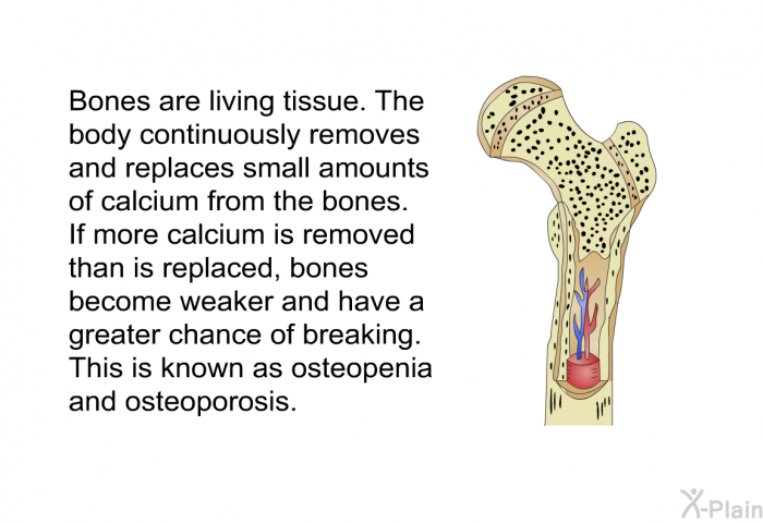 Bones are living tissue. The body continuously removes and replaces small amounts of calcium from the bones. If more calcium is removed than is replaced, bones become weaker and have a greater chance of breaking. This is known as osteopenia and osteoporosis.