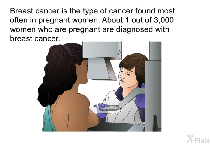 Breast cancer is the type of cancer found most often in pregnant women. About 1 out of 3,000 women who are pregnant are diagnosed with breast cancer.