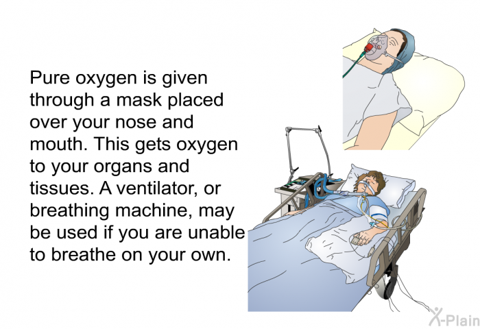 Pure oxygen is given through a mask placed over your nose and mouth. This gets oxygen to your organs and tissues. A ventilator, or breathing machine, may be used if you are unable to breathe on your own.