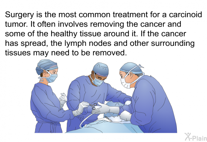 Surgery is the most common treatment for a carcinoid tumor. It often involves removing the cancer and some of the healthy tissue around it. If the cancer has spread, the lymph nodes and other surrounding tissues may need to be removed.
