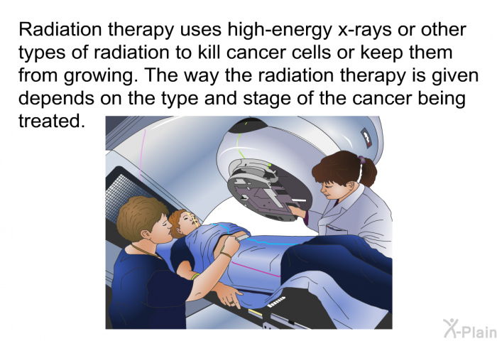 Radiation therapy uses high-energy x-rays or other types of radiation to kill cancer cells or keep them from growing. The way the radiation therapy is given depends on the type and stage of the cancer being treated.