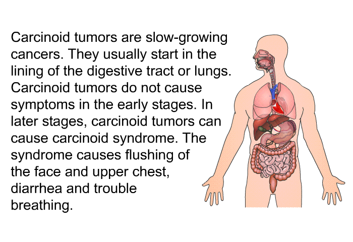 Carcinoid tumors are slow-growing cancers. They usually start in the lining of the digestive tract or lungs. Carcinoid tumors do not cause symptoms in the early stages. In later stages, carcinoid tumors can cause carcinoid syndrome. The syndrome causes flushing of the face and upper chest, diarrhea and trouble breathing.