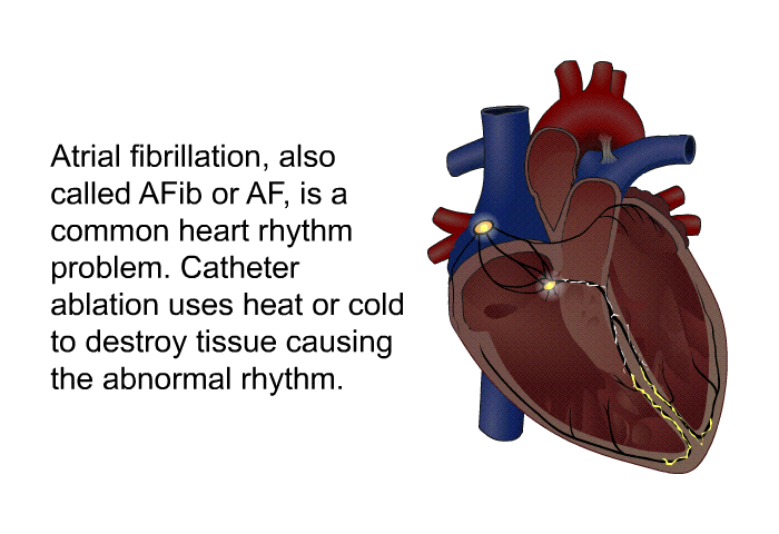 Atrial fibrillation, also called AFib or AF, is a common heart rhythm problem. Catheter ablation uses heat or cold to destroy tissue causing the abnormal rhythm.