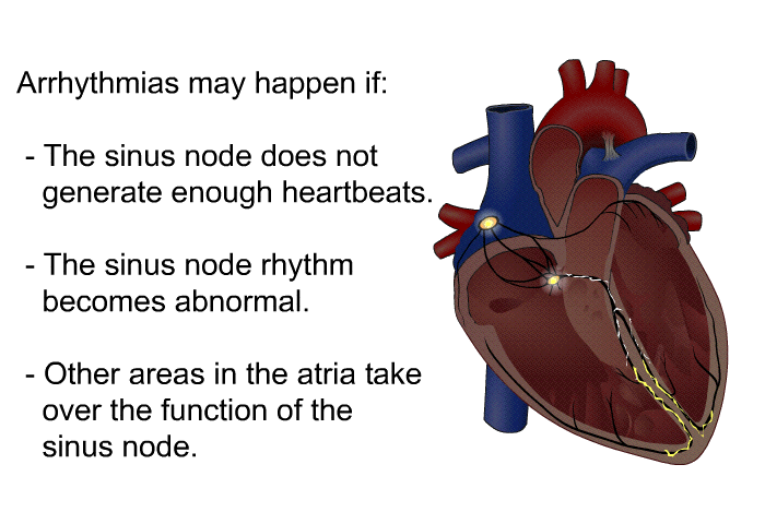 Arrhythmias may happen if:  The sinus node does not generate enough heartbeats. The sinus node rhythm becomes abnormal. Other areas in the atria take over the function of the sinus node.