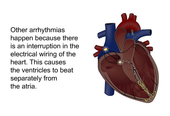 Other arrhythmias happen because there is an interruption in the electrical wiring of the heart. This causes the ventricles to beat separately from the atria.
