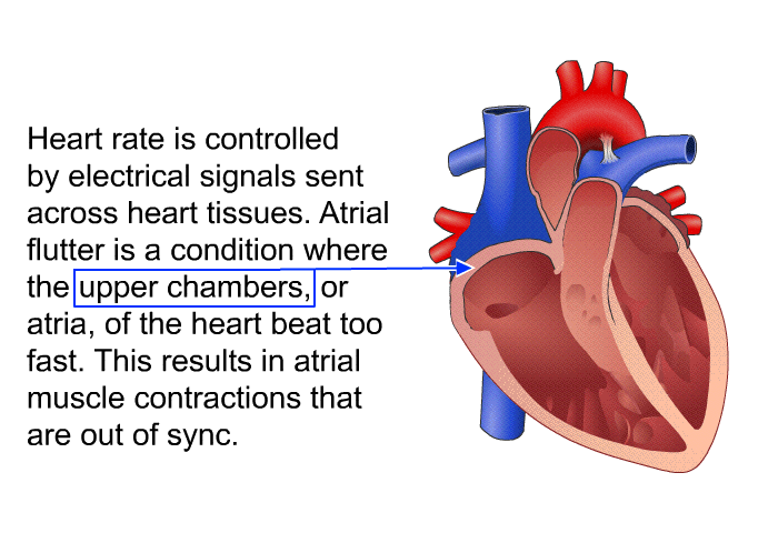 Heart rate is controlled by electrical signals sent across heart tissues. Atrial flutter is a condition where the upper chambers, or atria, of the heart beat too fast. This results in atrial muscle contractions that are out of sync.