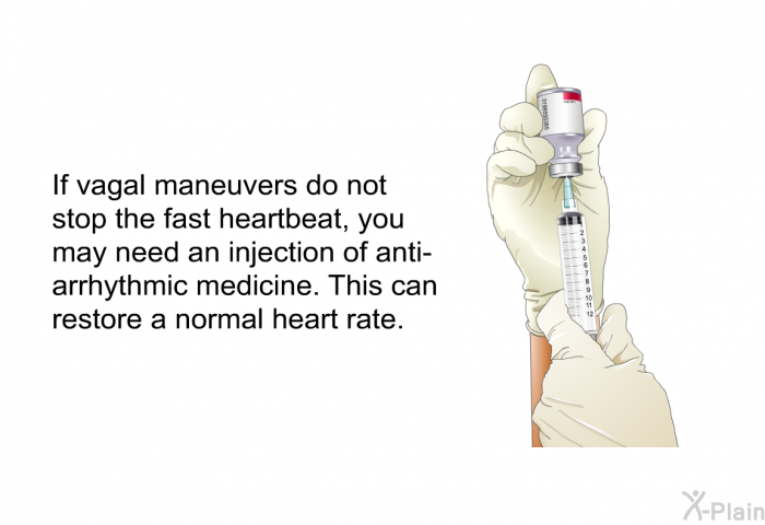 If vagal maneuvers do not stop the fast heartbeat, you may need an injection of anti-arrhythmic medicine. This can restore a normal heart rate.