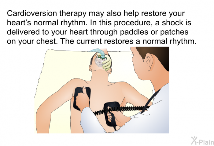 Cardioversion therapy may also help restore your heart's normal rhythm. In this procedure, a shock is delivered to your heart through paddles or patches on your chest. The current restores a normal rhythm.