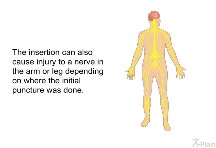 The insertion can also cause injury to a nerve in the arm or leg depending on where the initial puncture was done.