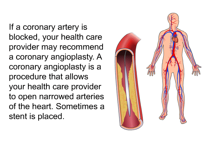 If a coronary artery is blocked, your health care provider may recommend a coronary angioplasty. A coronary angioplasty is a procedure that allows your health care provider to open narrowed arteries of the heart. Sometimes a stent is placed.
