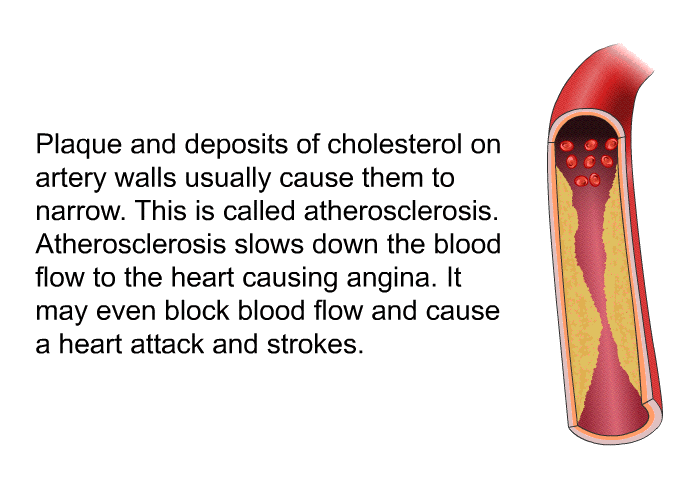 Plaque and deposits of cholesterol on artery walls usually cause them to narrow. This is called atherosclerosis. Atherosclerosis slows down the blood flow to the heart causing angina. It may even block blood flow and cause a heart attack and strokes.