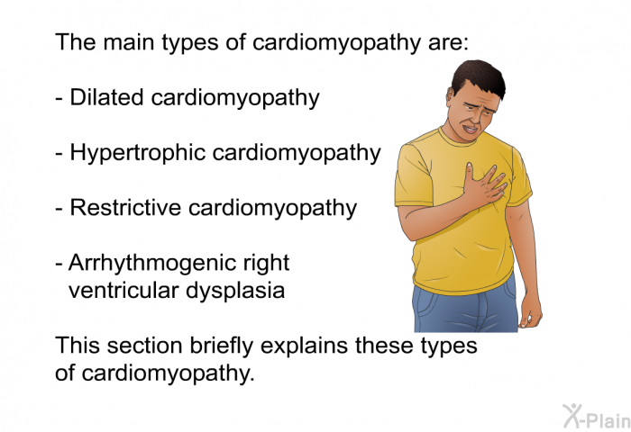 The main types of cardiomyopathy are:  Dilated cardiomyopathy Hypertrophic cardiomyopathy Restrictive cardiomyopathy Arrhythmogenic right ventricular dysplasia  
 This section briefly explains these types of cardiomyopathy.