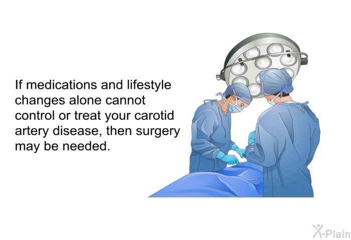 If medications and lifestyle changes alone cannot control or treat your carotid artery disease, then surgery may be needed.