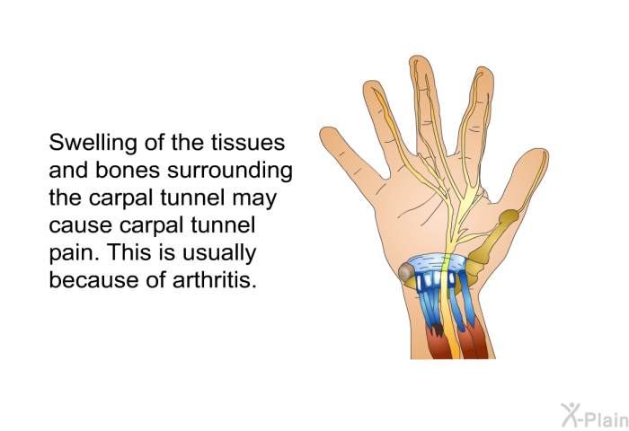 Swelling of the tissues and bones surrounding the carpal tunnel may cause carpal tunnel pain. This is usually because of arthritis.