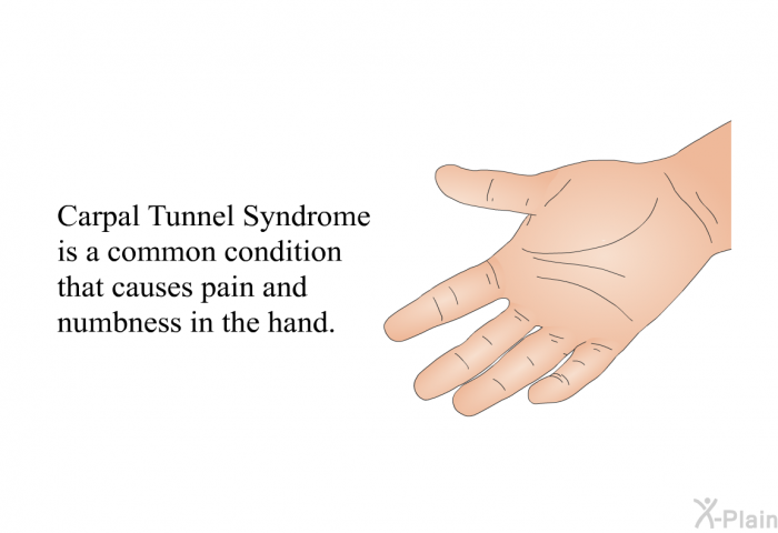 Carpal Tunnel Syndrome is a common condition that causes pain and numbness in the hand.