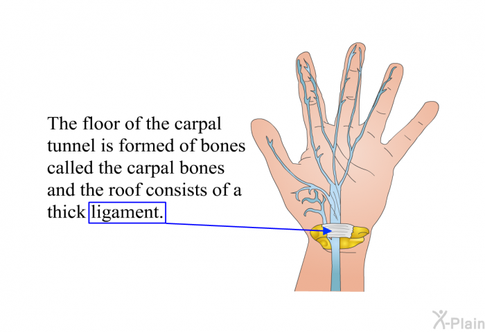The floor of the carpal tunnel is formed of bones called the carpal bones and the roof consists of a thick ligament.