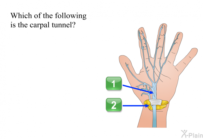 Which of the following is the carpal tunnel? Press A or B