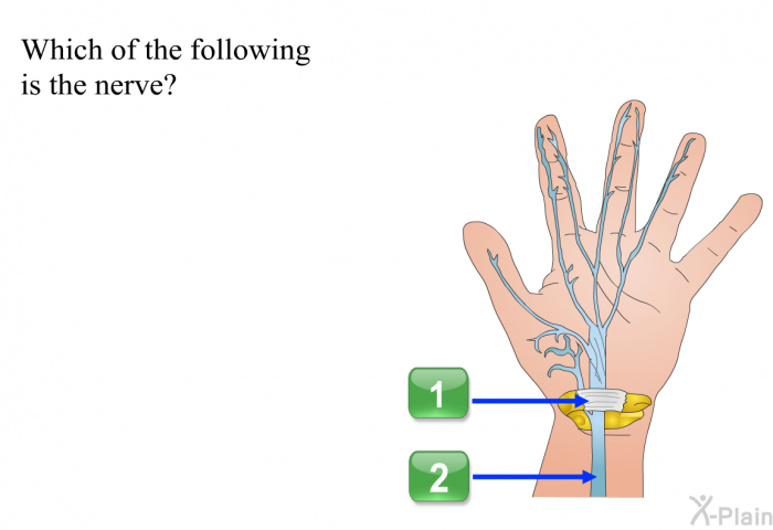 Which of the following is the nerve? Press A or B