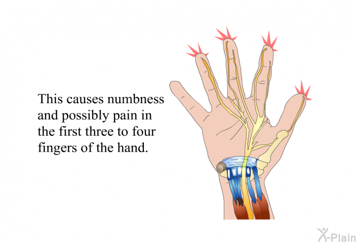 This causes numbness and possibly pain in the first three to four fingers of the hand.