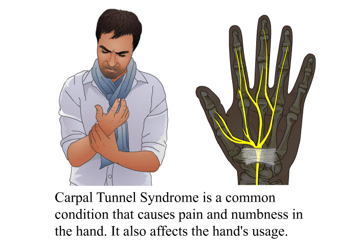  : Carpal Tunnel Release - Open