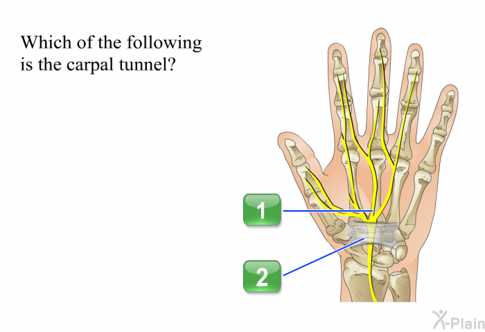 Which of the following is the carpal tunnel?
