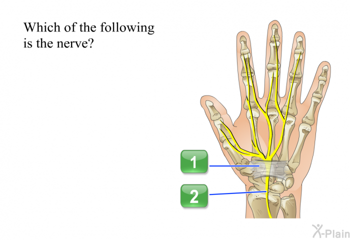 Which of the following is the nerve?