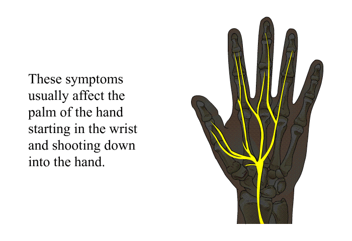 These symptoms usually affect the palm of the hand starting in the wrist and shooting down into the hand.