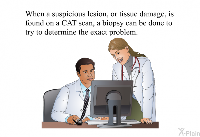 When a suspicious lesion, or tissue damage, is found on a CAT scan, a biopsy can be done to try to determine the exact problem.