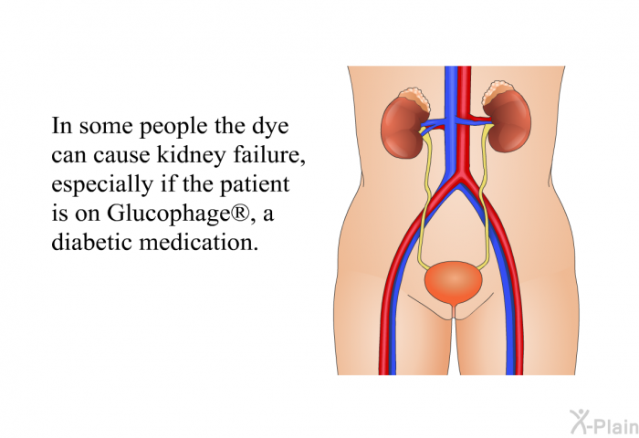 In some people the dye can cause kidney failure, especially if the patient is on Glucophage , a diabetic medication.