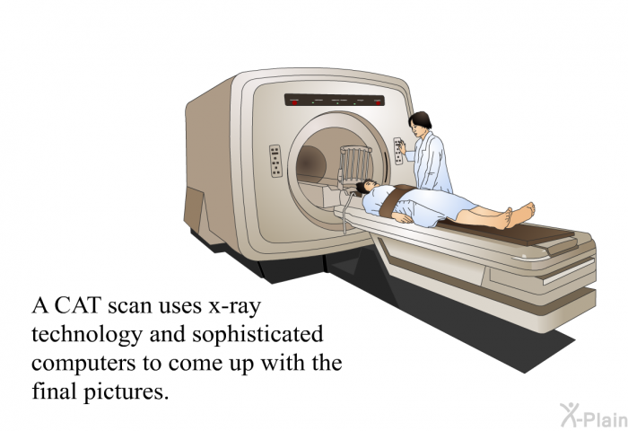 A CAT scan uses x-ray technology and sophisticated computers to come up with the final pictures.