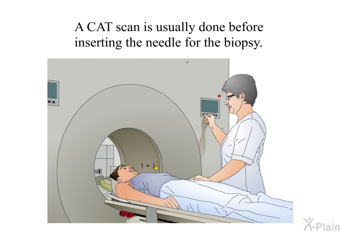 A CAT scan is usually done before inserting the needle for the biopsy.