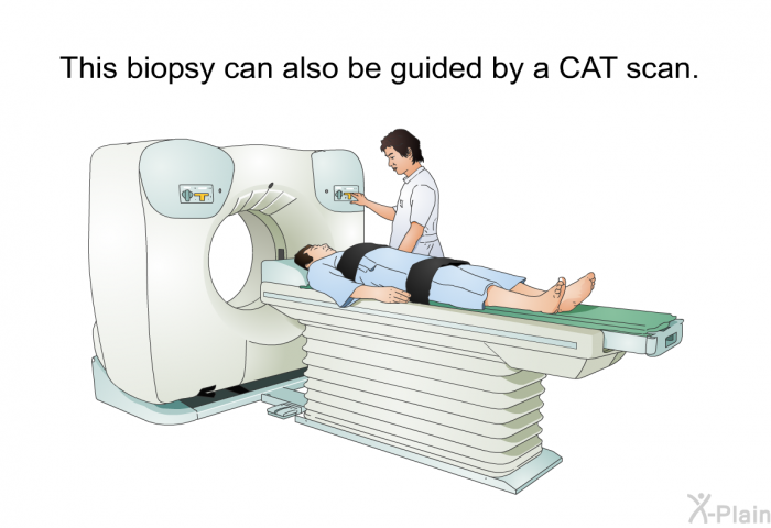 This biopsy can also be guided by a CAT scan.