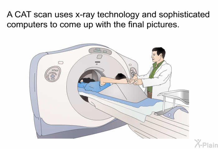 A CAT scan uses x-ray technology and sophisticated computers to come up with the final pictures.