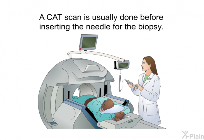 A CAT scan is usually done before inserting the needle for the biopsy.