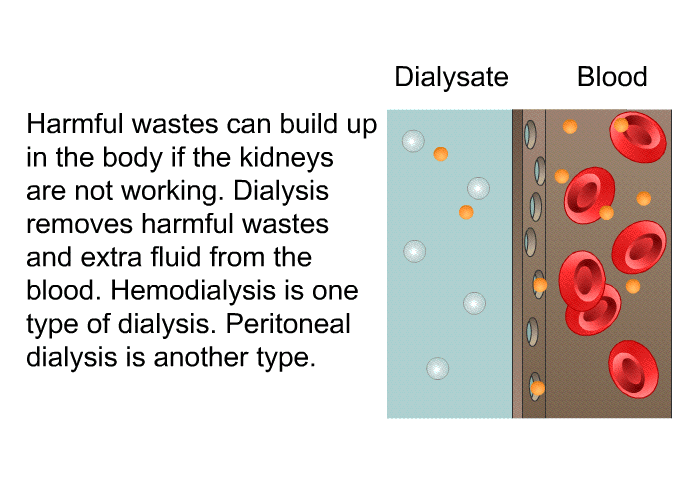 Harmful wastes can build up in the body if the kidneys are not working. Dialysis removes harmful wastes and extra fluid from the blood. Hemodialysis is one type of dialysis. Peritoneal dialysis is another type.