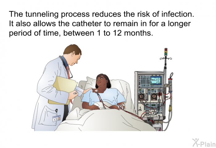 The tunneling process reduces the risk of infection. It also allows the catheter to remain in for a longer period of time, between 1 to 12 months.