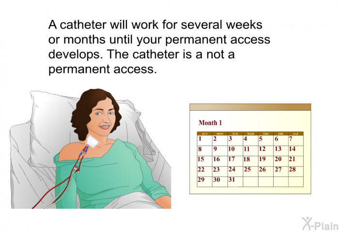 A catheter will work for several weeks or months until your permanent access develops. The catheter is a not a permanent access.