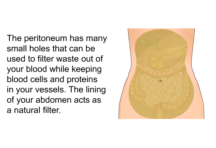 The peritoneum has many small holes that can be used to filter waste out of your blood while keeping blood cells and proteins in your vessels. The lining of your abdomen acts as a natural filter.
