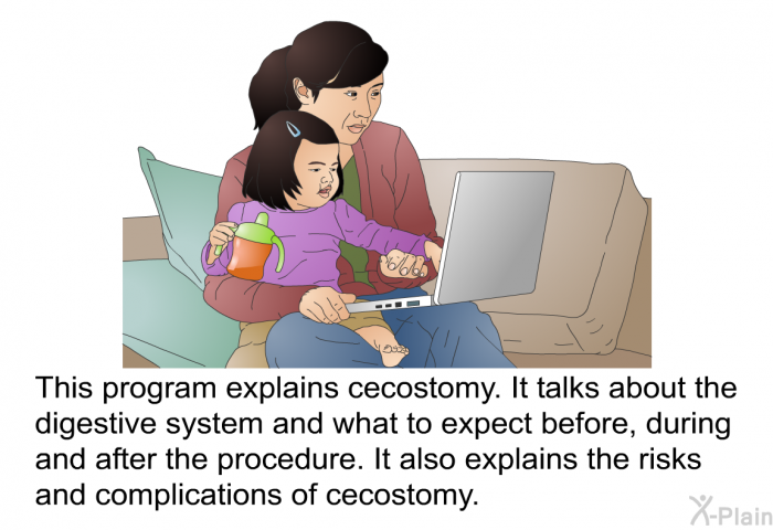 This health information explains cecostomy. It talks about the digestive system and what to expect before, during and after the procedure. It also explains the risks and complications of cecostomy.