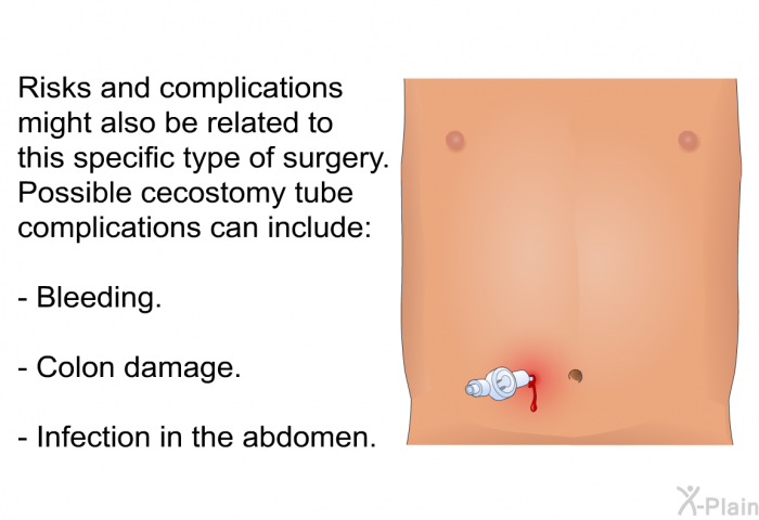 Risks and complications might also be related to this specific type of surgery. Possible cecostomy tube complications can include:  Bleeding. Colon damage. Infection in the abdomen.