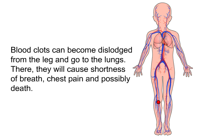Blood clots can become dislodged from the leg and go to the lungs. There, they will cause shortness of breath, chest pain and possibly death.