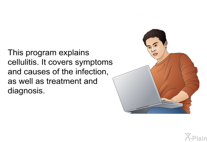 This health information explains cellulitis. It covers symptoms and causes of the infection, as well as treatment and diagnosis.