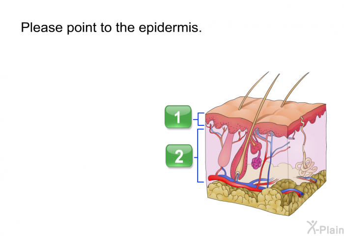 Please point to the epidermis.