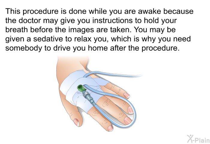 This procedure is done while you are awake because the doctor may give you instructions to hold your breath before the images are taken. You may be given a sedative to relax you, which is why you need somebody to drive you home after the procedure.