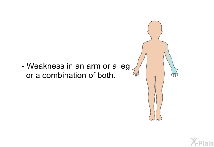 Weakness in an arm or a leg or a combination of both.